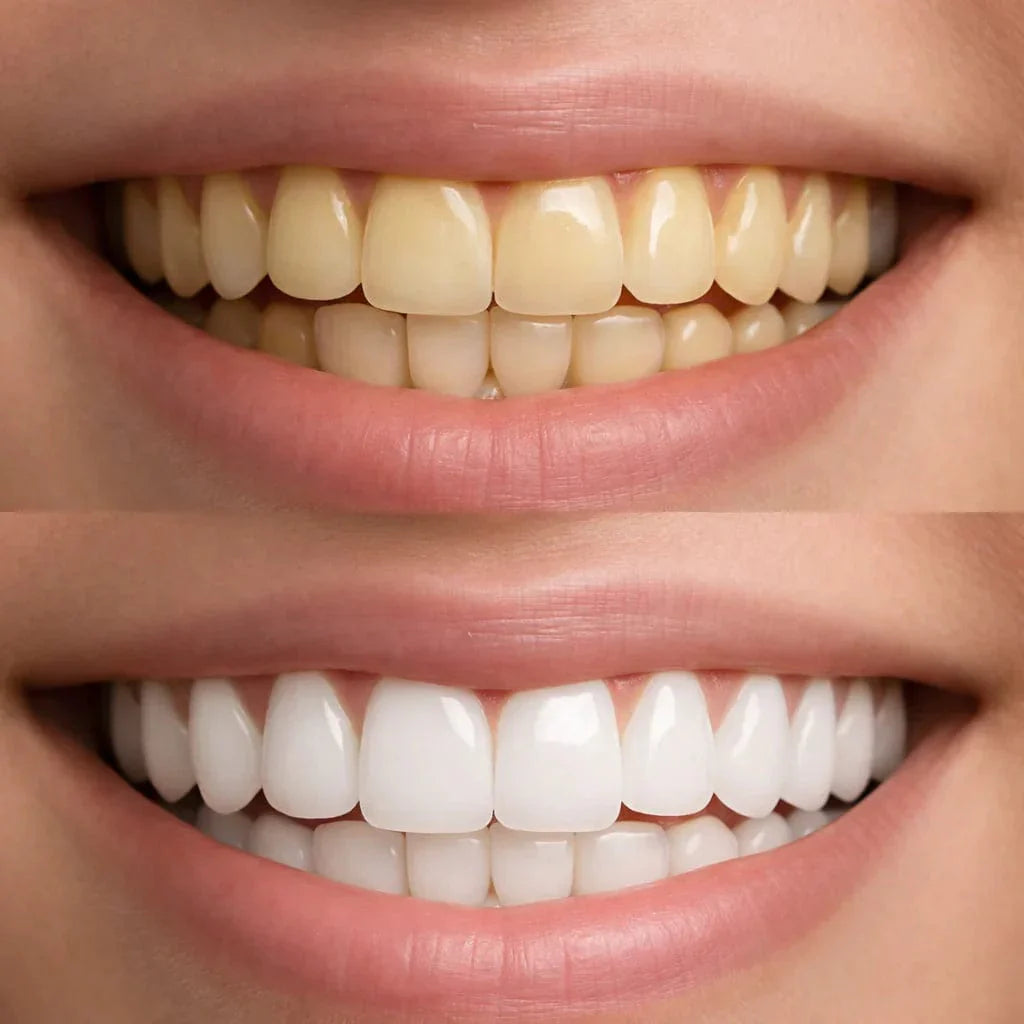 ✨ Obtenez un sourire plus blanc dès la première utilisation !