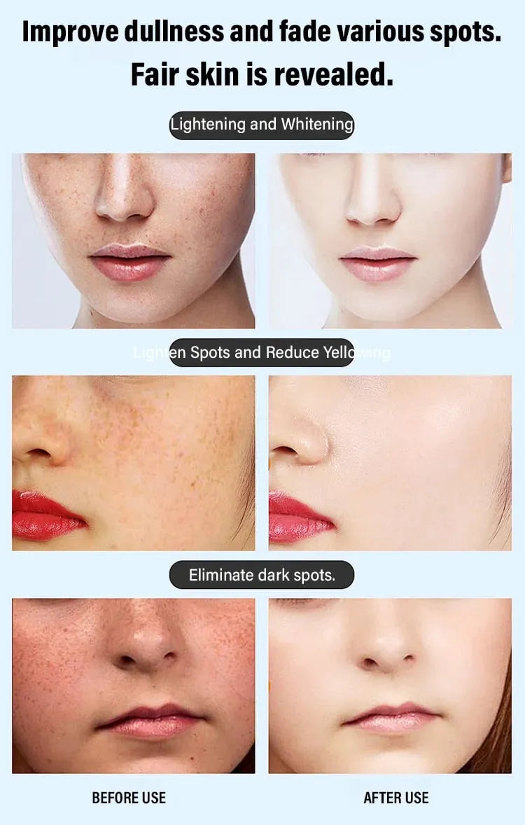 Sérum anti-taches de rousseur pour le visage : répare et nettoie les taches brunes