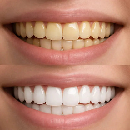 ✨ Obtenez un sourire plus blanc dès la première utilisation !